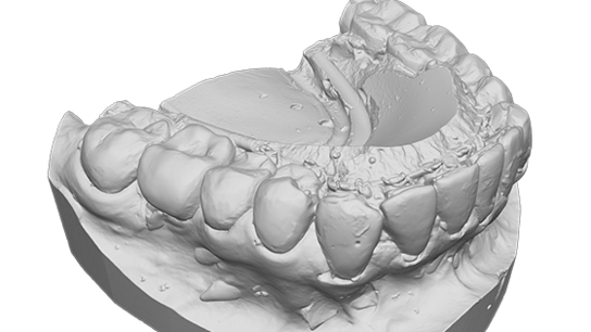 Plaster cast of teeth