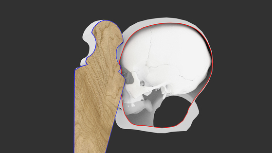 Advanced Laser Imaging