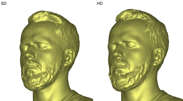 artec-leo-sd-vs-hd-hard-to-reach-areas