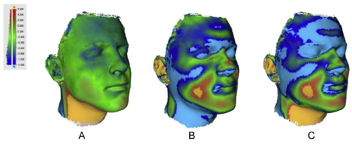 3D face scans analysed by Artec Studio